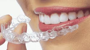 Clear Teeth Aligners
