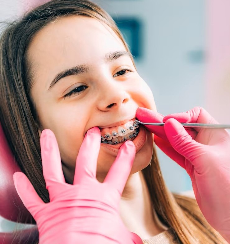 Orthodontic Treatment