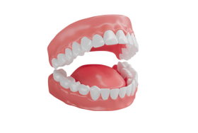 Implants vs Dentures