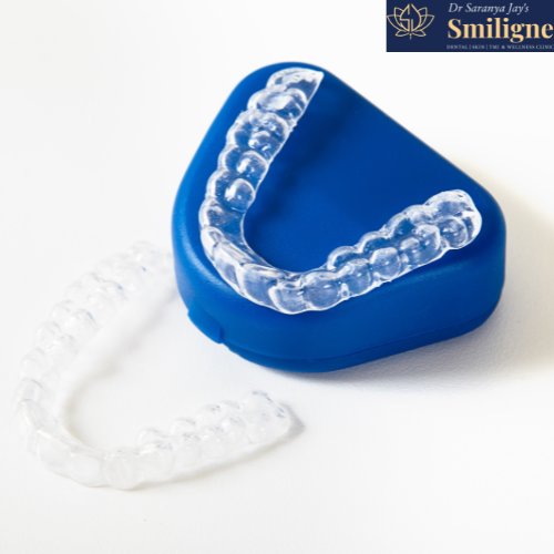 Aligners vs. Retainers