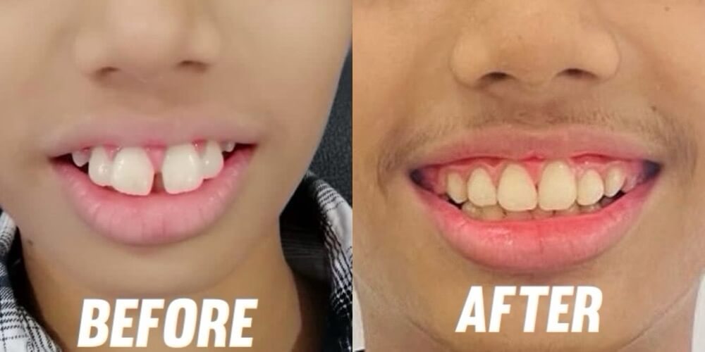 Smiligne - Dental, Skin, TMJ & Wellness Clinic