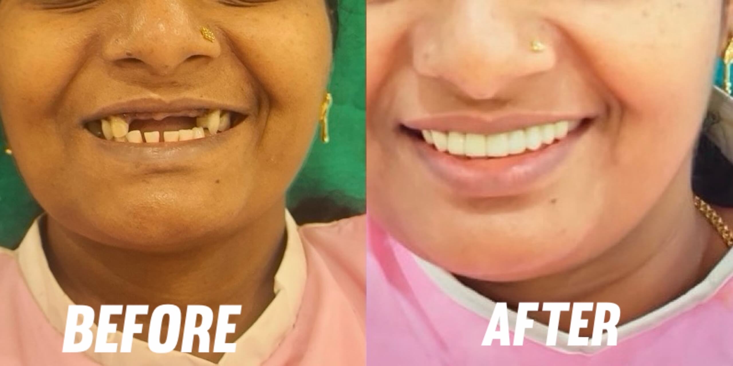 Smiligne - Dental, Skin, TMJ & Wellness Clinic