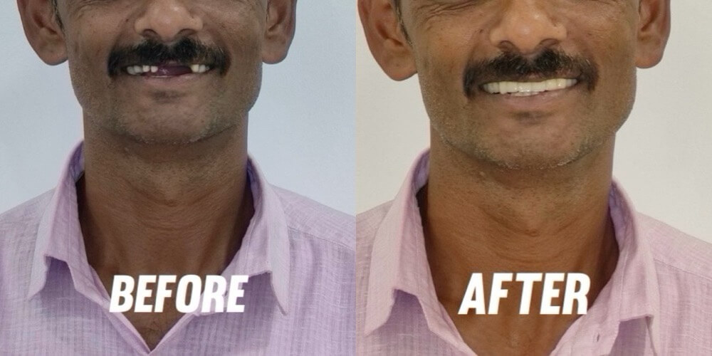 Smiligne - Dental, Skin, TMJ & Wellness Clinic