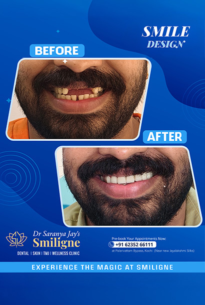 Smiligne - Dental, Skin, TMJ & Wellness Clinic