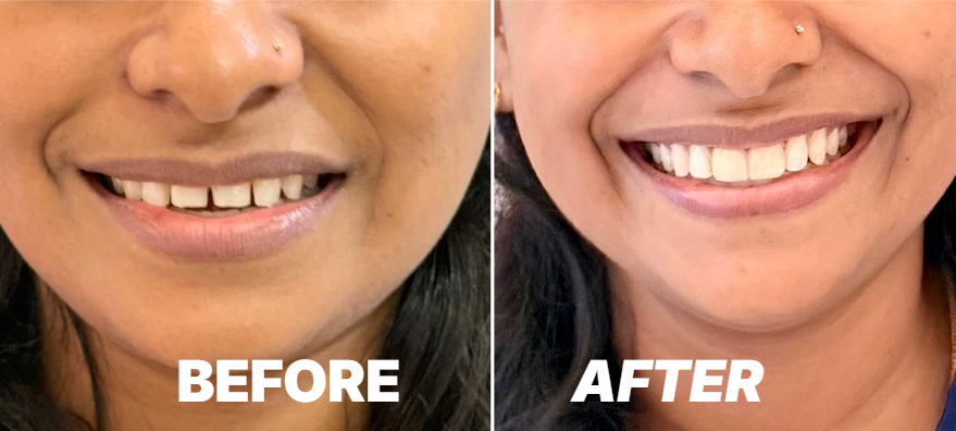 Best Cosmetic Dental Clinic in Kochi