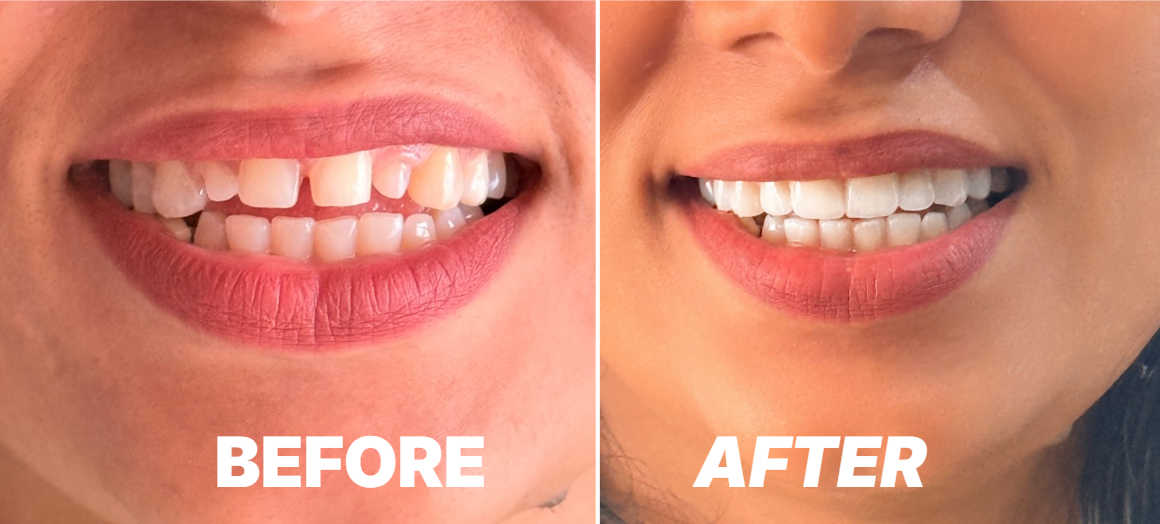 Best Cosmetic Dental Clinic in Kochi