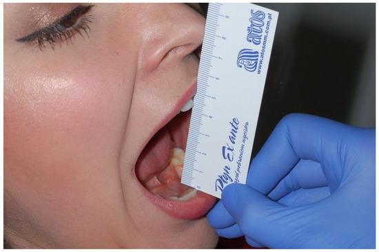 Best TMJ Treatment in Kochi