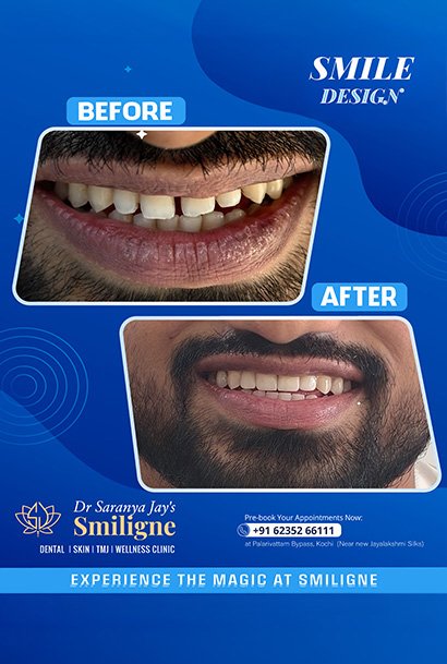 Smiligne - Dental, Skin, TMJ & Wellness Clinic