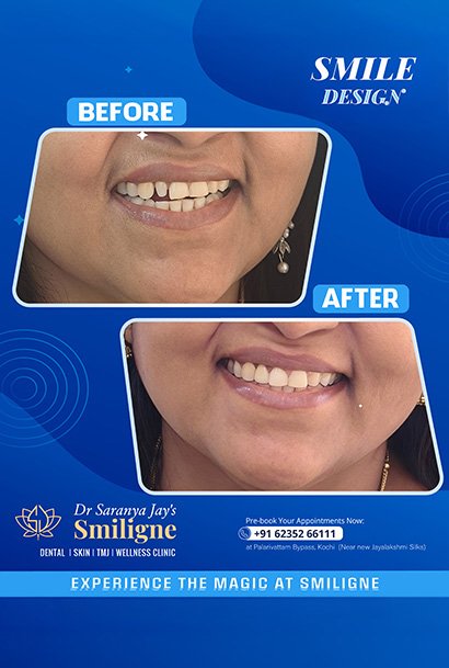 Smiligne - Dental, Skin, TMJ & Wellness Clinic