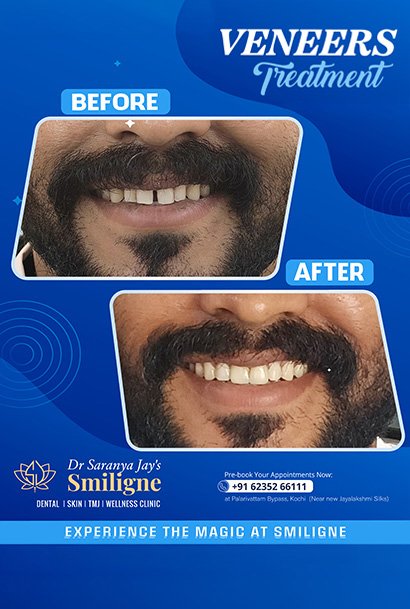 Smiligne - Dental, Skin, TMJ & Wellness Clinic