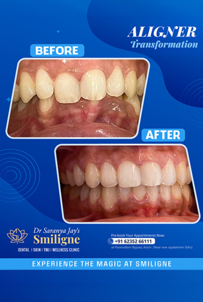 Smiligne - Dental, Skin, TMJ & Wellness Clinic