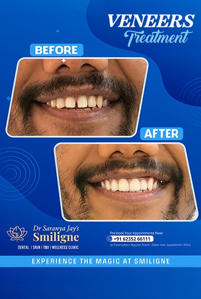 Smiligne - Dental, Skin, TMJ & Wellness Clinic
