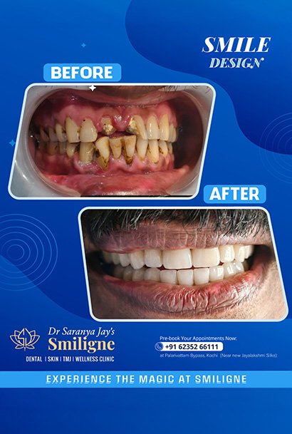 Smiligne - Dental, Skin, TMJ & Wellness Clinic