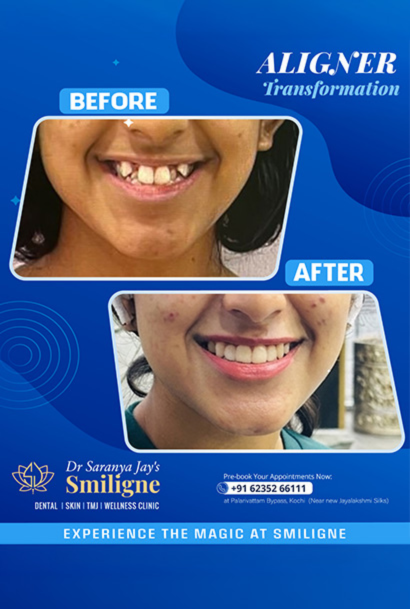 Smiligne - Dental, Skin, TMJ & Wellness Clinic
