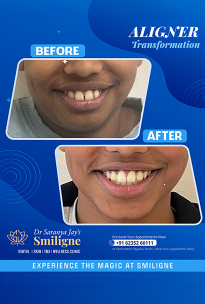 Smiligne - Dental, Skin, TMJ & Wellness Clinic