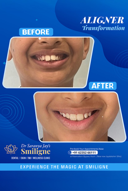 Smiligne - Dental, Skin, TMJ & Wellness Clinic