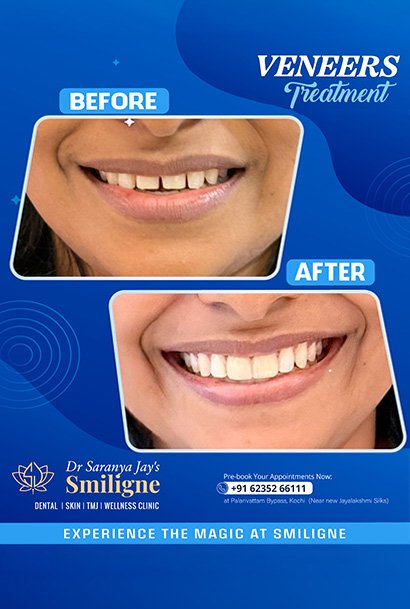 Smiligne - Dental, Skin, TMJ & Wellness Clinic