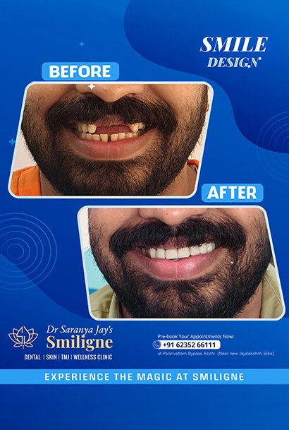 Smiligne - Dental, Skin, TMJ & Wellness Clinic