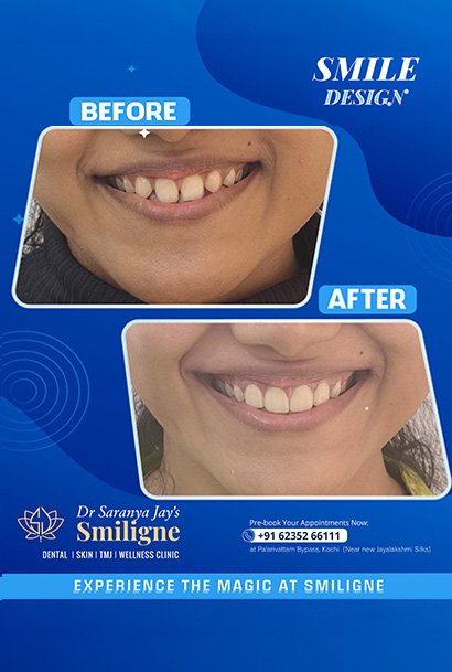 Smiligne - Dental, Skin, TMJ & Wellness Clinic