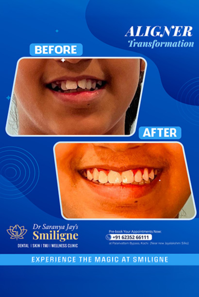 Smiligne - Dental, Skin, TMJ & Wellness Clinic