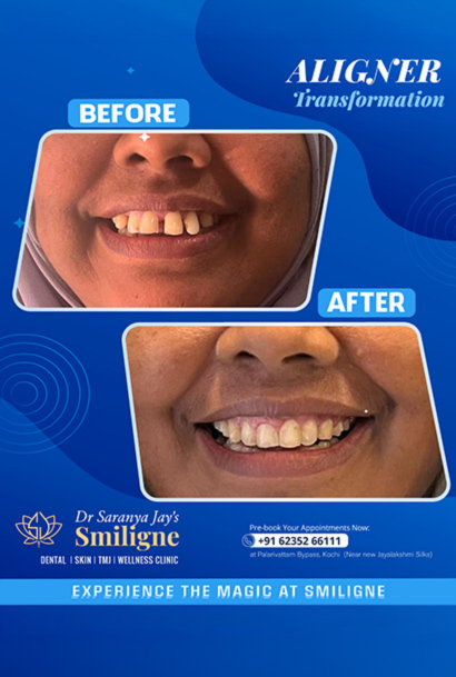 Smiligne - Dental, Skin, TMJ & Wellness Clinic