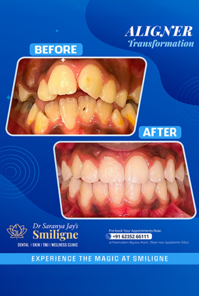 Smiligne - Dental, Skin, TMJ & Wellness Clinic